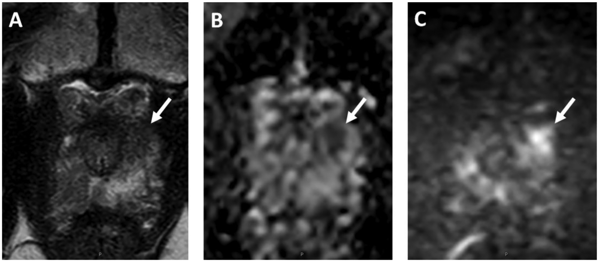 Figure 2: