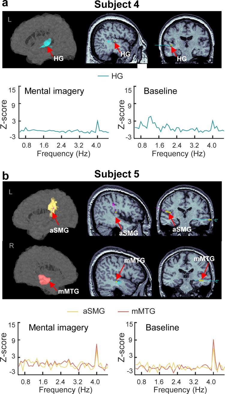 Figure 5—figure supplement 1.