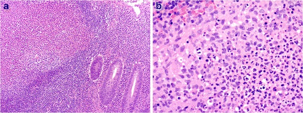 Fig. 12