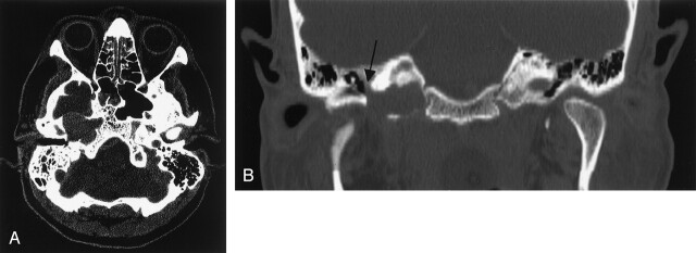 Fig 4.