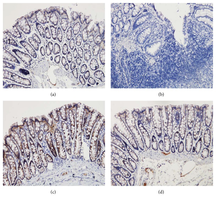 Figure 17