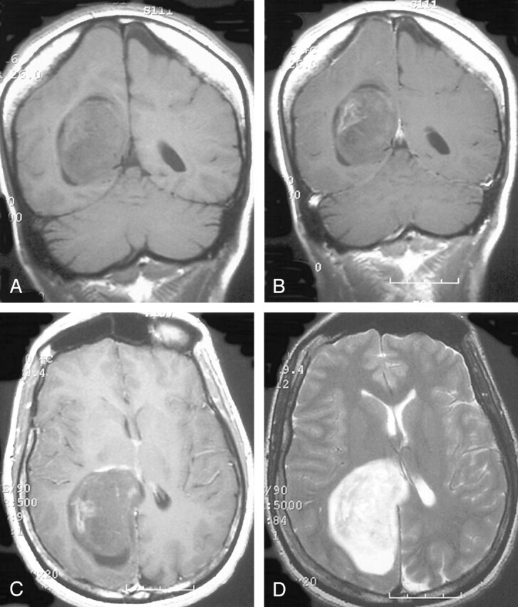 Fig 2.