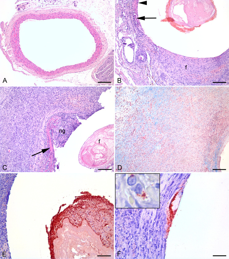 Fig 5