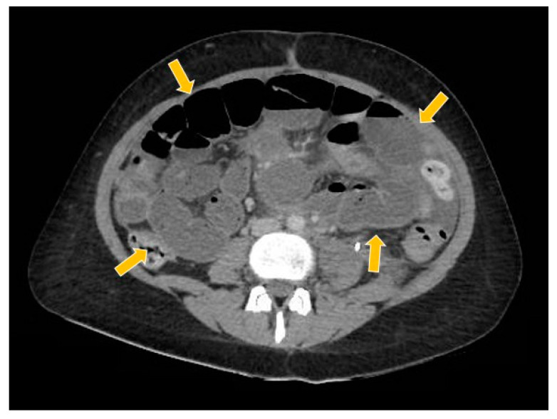 Figure 10