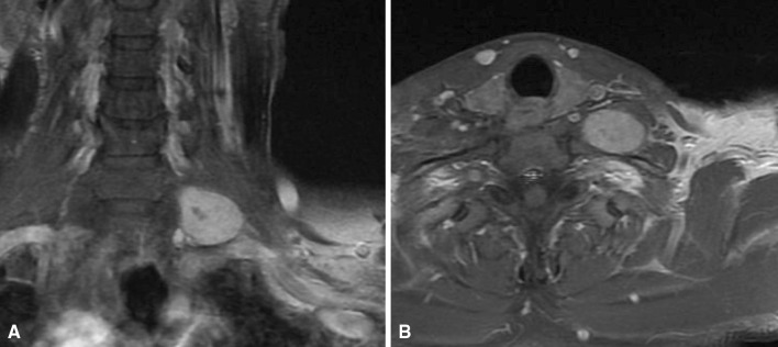 Fig. 1A–B