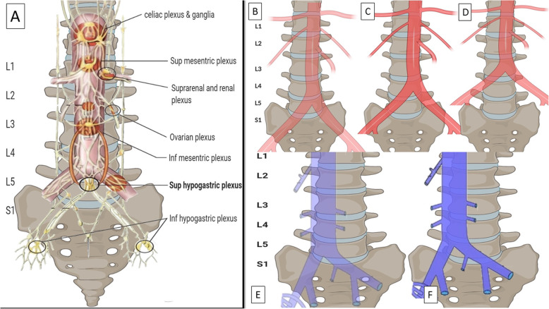 Superior hypogastric nerve block (SHNB) for pain control after uterine ...