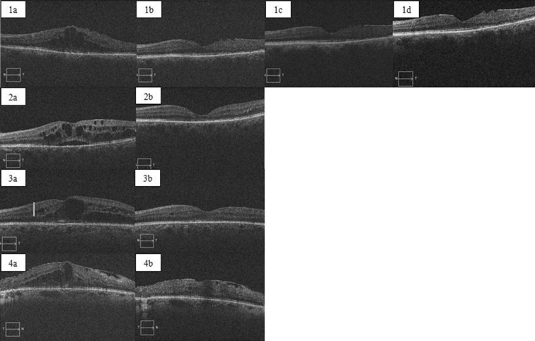 Fig. 3