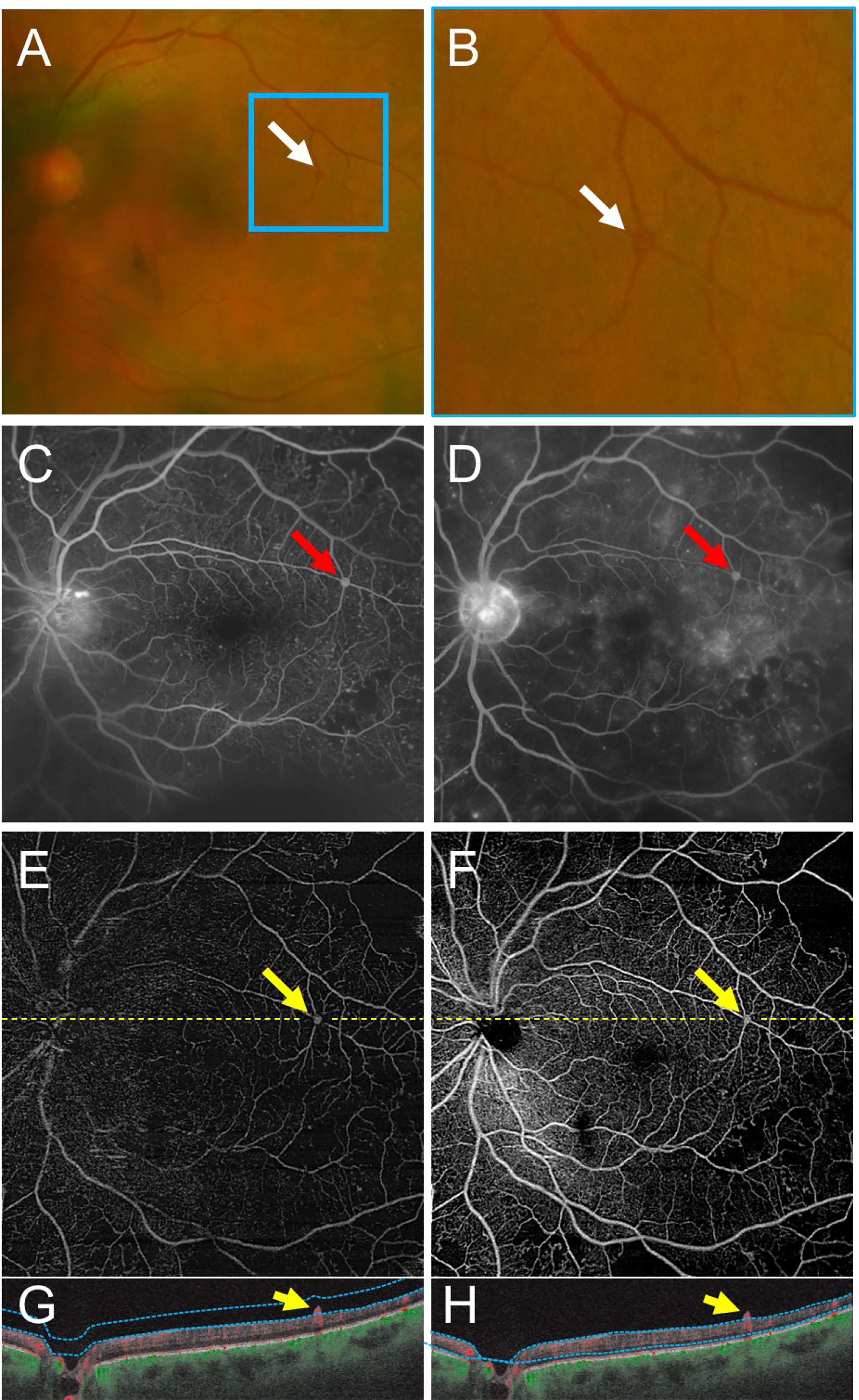 Figure 1 –