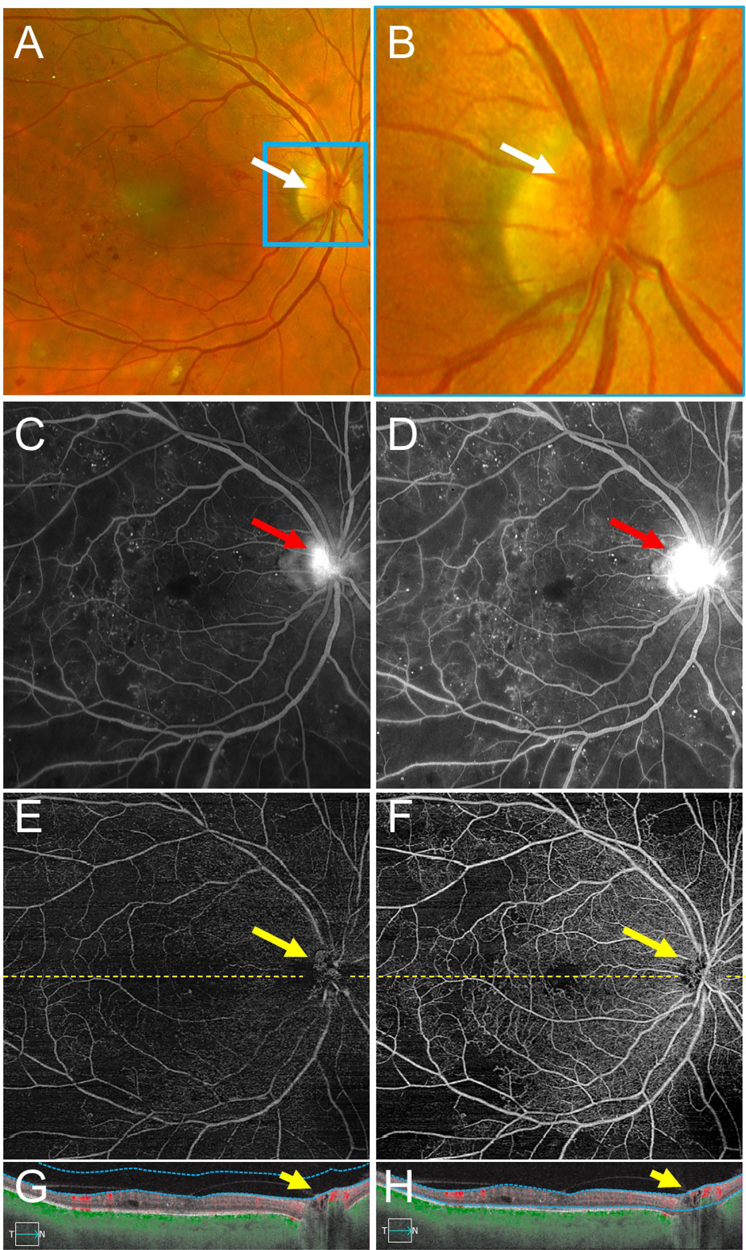 Figure 3 –