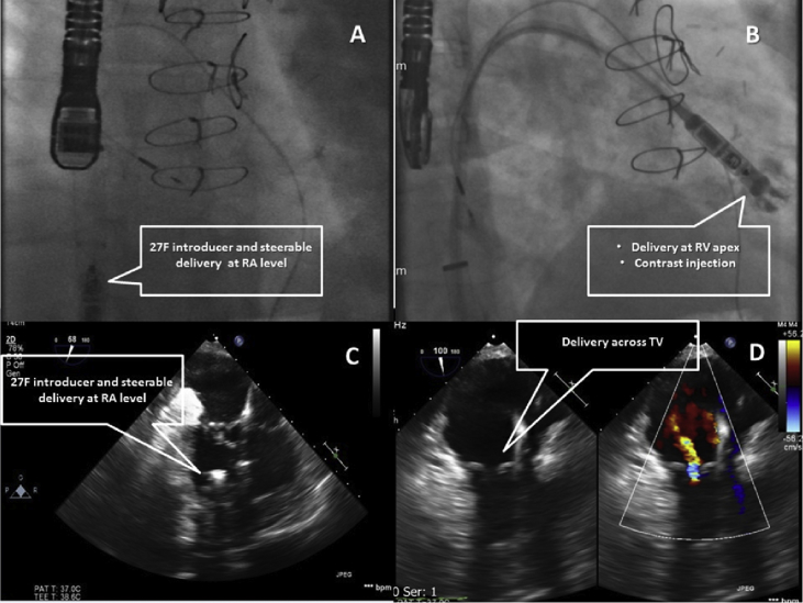 Fig. 3