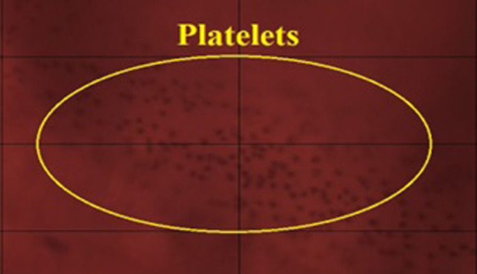 Fig 3