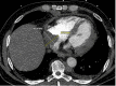 A close-up of an x-ray of a chest AI-generated content may be incorrect.