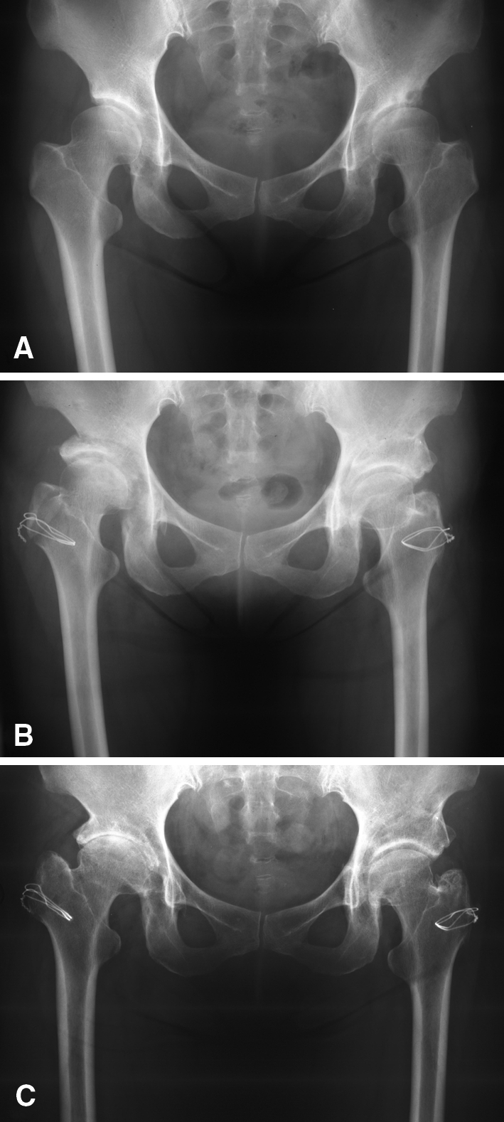 Fig. 1A–C