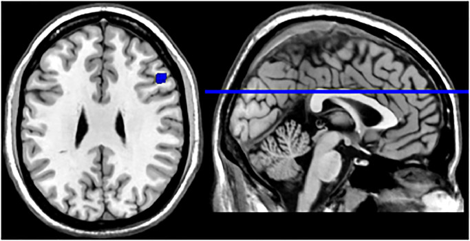 Fig. 3