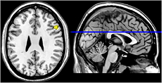 Fig. 2