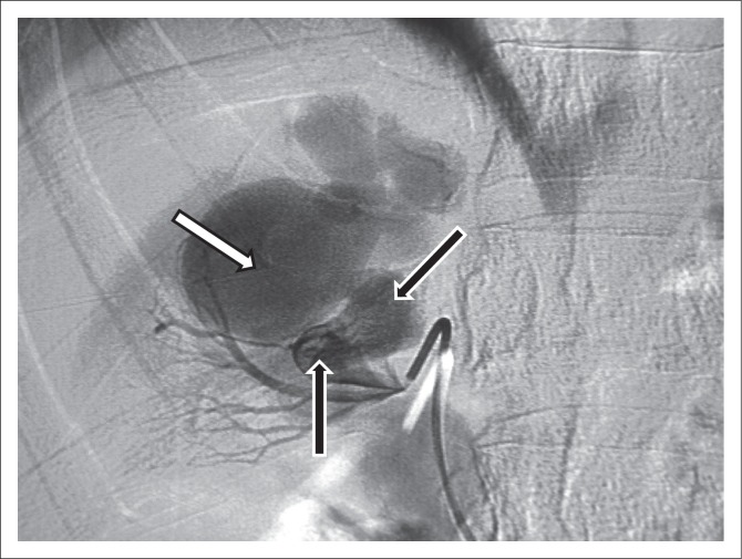 FIGURE 3