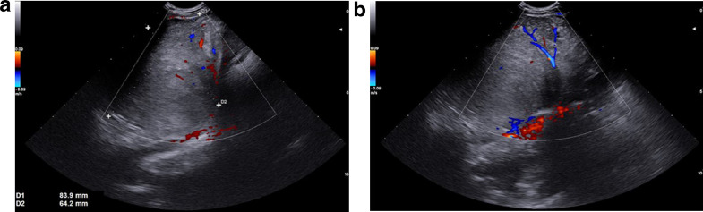 Fig 2