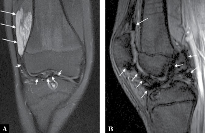 Fig. 18.