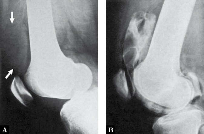 Fig. 13.