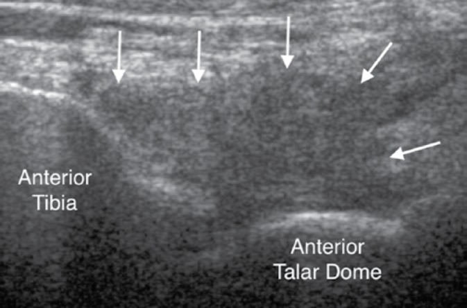 Fig. 14.