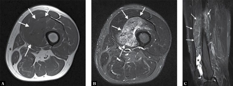 Fig. 15.