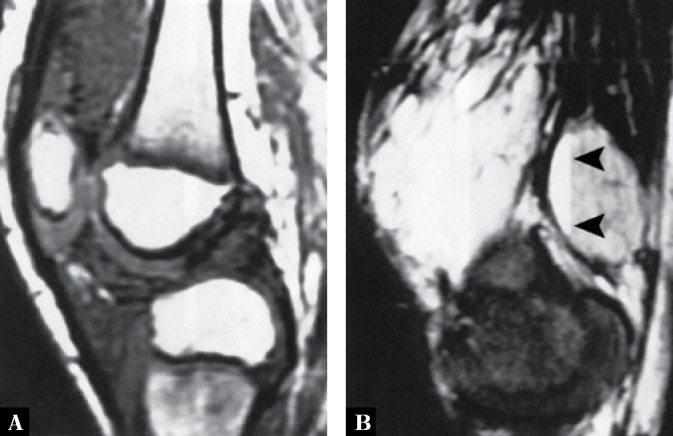 Fig. 19.