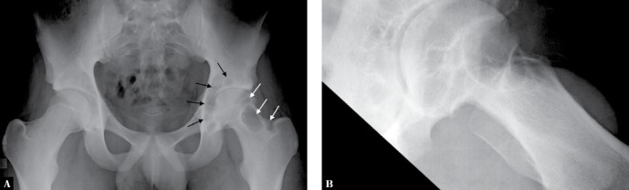 Fig. 12.