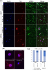 Panel A shows immunofluorescence images with DAPI (blue), FUS (red), and NF200 (green) staining across different conditions, revealing varying FUS localization in neurons. Panel B displays sub-images highlighting FUS in nuclei, cytosol, and a dead cell. Panel C presents a bar graph illustrating FUS localization in nucleus and cytosol, and the proportion of dead cells under different conditions (DIV7 and DIV35).