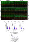 Fluorescent microscopy images and scatter plots showing axon growth in a study. Panel A presents three time points (DIV7, DIV11, DIV14) with control and FUS_1_4 samples. Axons appear in green and red, with annotations for migration surface (m.s) and axon compartment (a.c). Panels B, C, and D display scatter plots comparing axon lengths for each time point, with significant differences marked (****, ***, n.s.). Panel E shows a bar graph comparing the number of axons reaching the axon compartment, with significant differences noted.