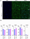 (A) Fluorescent microscopy images showing cell cultures. Left to right: DAPI stained nuclei in blue, CHAT expression in green, and merged images. Two rows compare Control_4 and FUS_1_4 samples at a scale of 100 micrometers. (B) Bar graphs depicting relative quantification (RQ) of gene expression for CHAT, MNX1, TUBB3, LHX3, and NANOG, comparing Control_4 and FUS_1_4 samples. Significant differences are marked with an asterisk, and non-significant differences are labeled “n.s”.