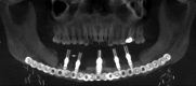 Fig. 15
