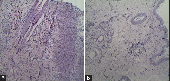 Figure-3
