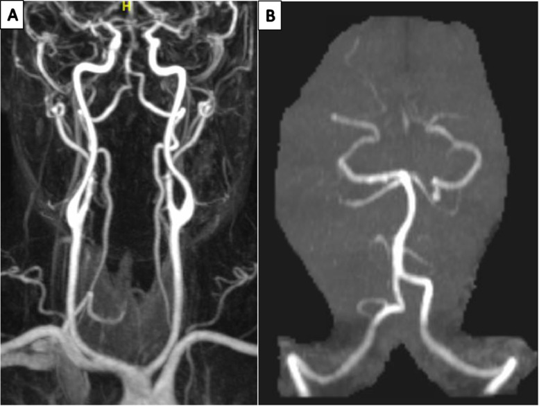 Fig 3: