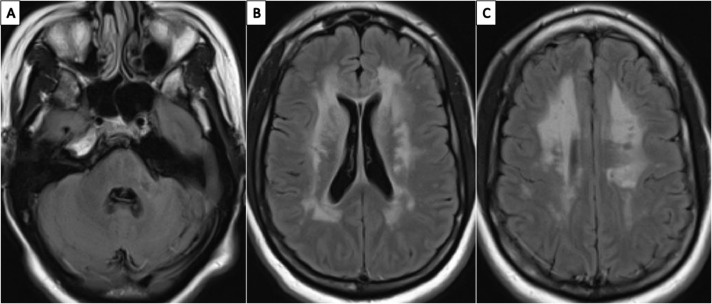 Fig 2: