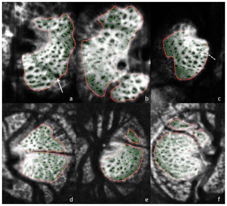 Fig. 3