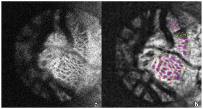 Fig. 4