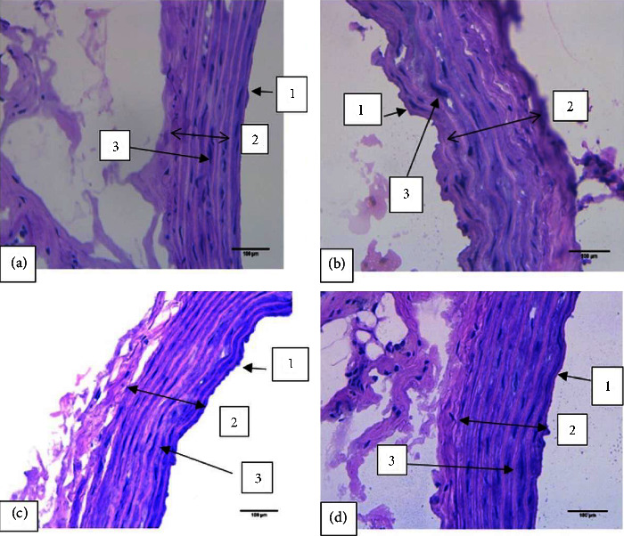 Figure 11