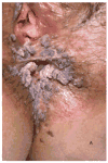 Figure III