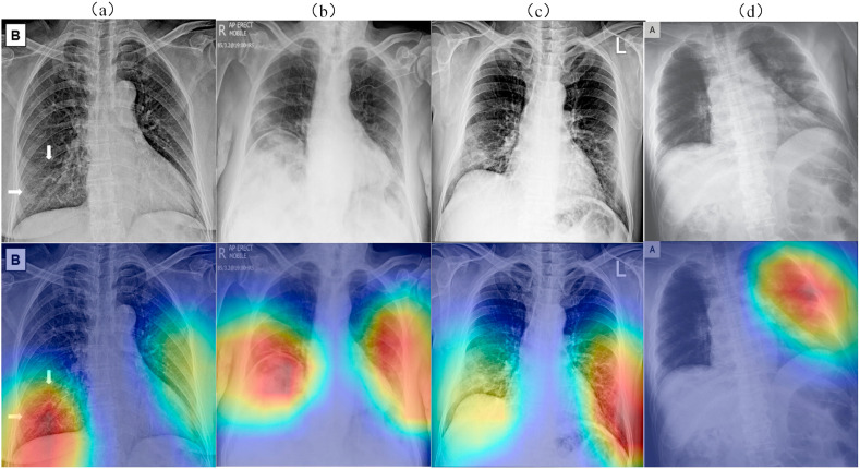 Fig. 11