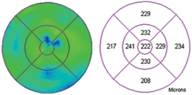 Fig. 3