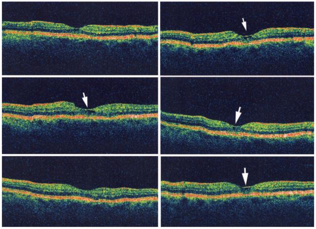 Fig. 9