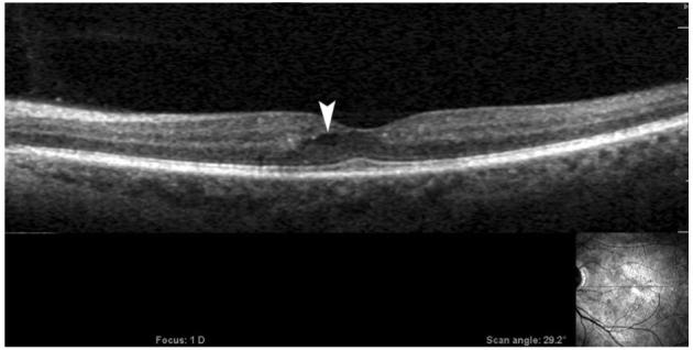 Fig. 6