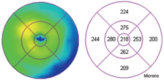 Fig. 10