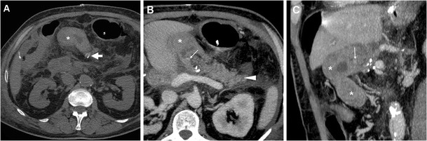 Fig. 11