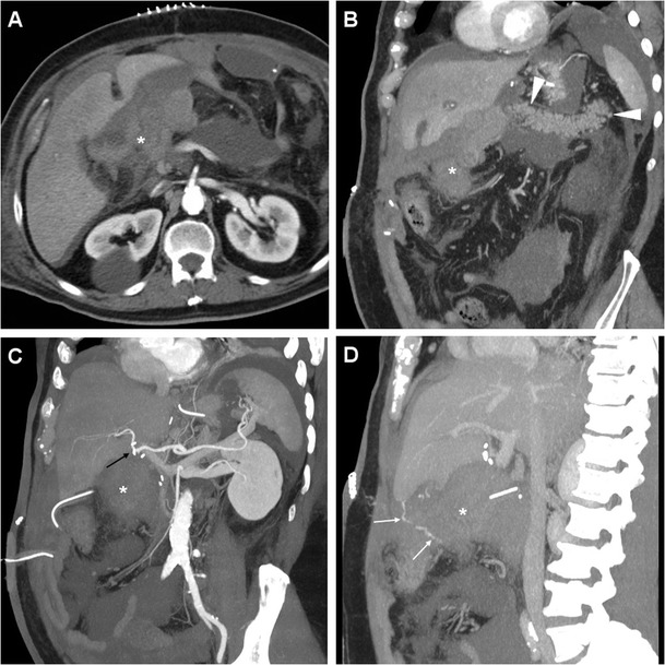 Fig. 12