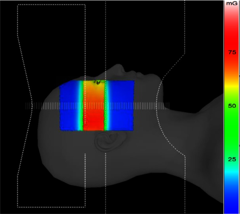 Fig. 13