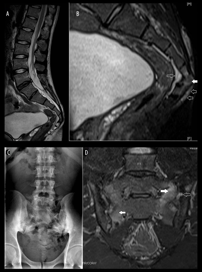 Figure 14