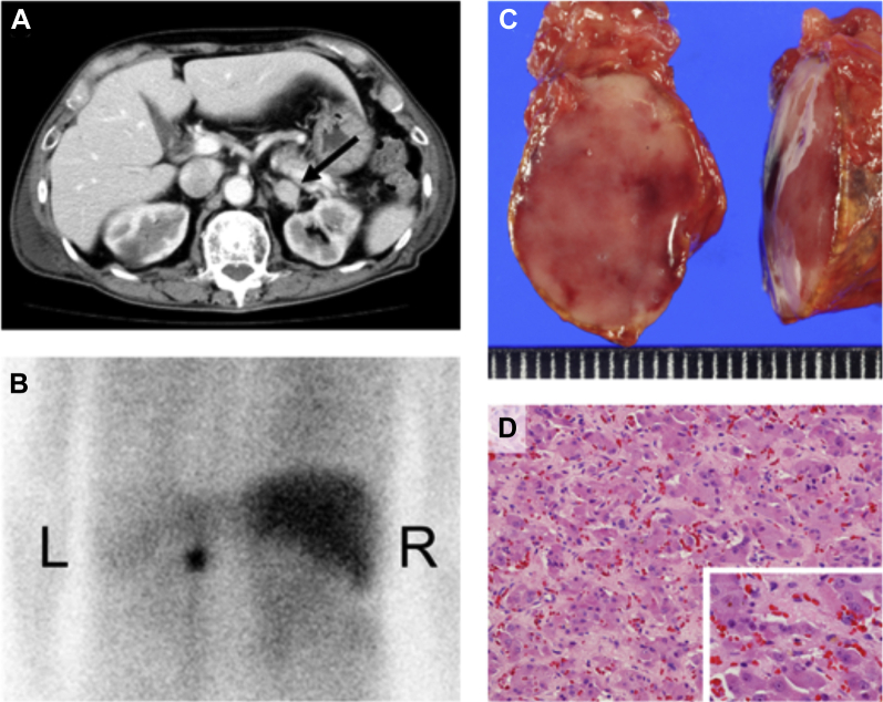 Figure 1
