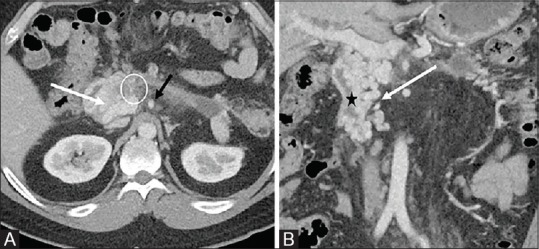 Figure 1 (A and B)