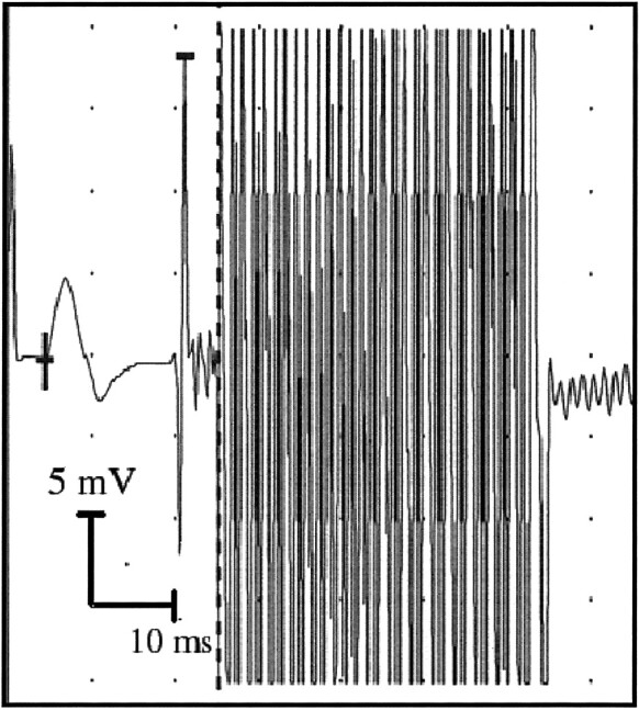 fig 1.